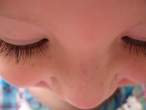 ...in deine Sommersprossen