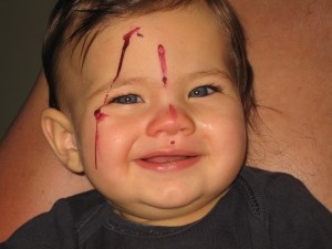 Was ist hier mit Kayla passiert?